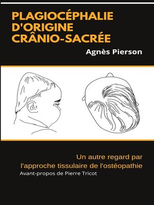 cover image of plagiocéphalie d'origine crânio-sacrée